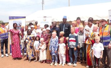 Un appel à protéger les personnes atteintes d’albinisme contre les effets néfastes de l’exposition solaire lancé à Bondoukou