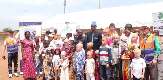 Un appel à protéger les personnes atteintes d’albinisme contre les effets néfastes de l’exposition solaire lancé à Bondoukou