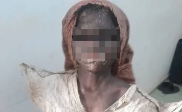 Maltraitance à Bouaké : une fillette de 11 ans sauvée des violences de sa grand-mère